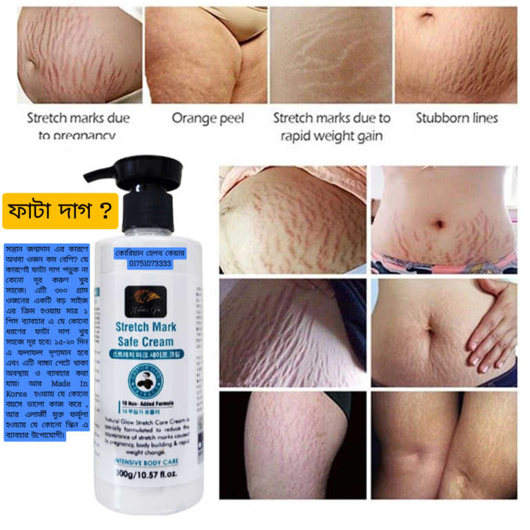 Stretch marks care cream