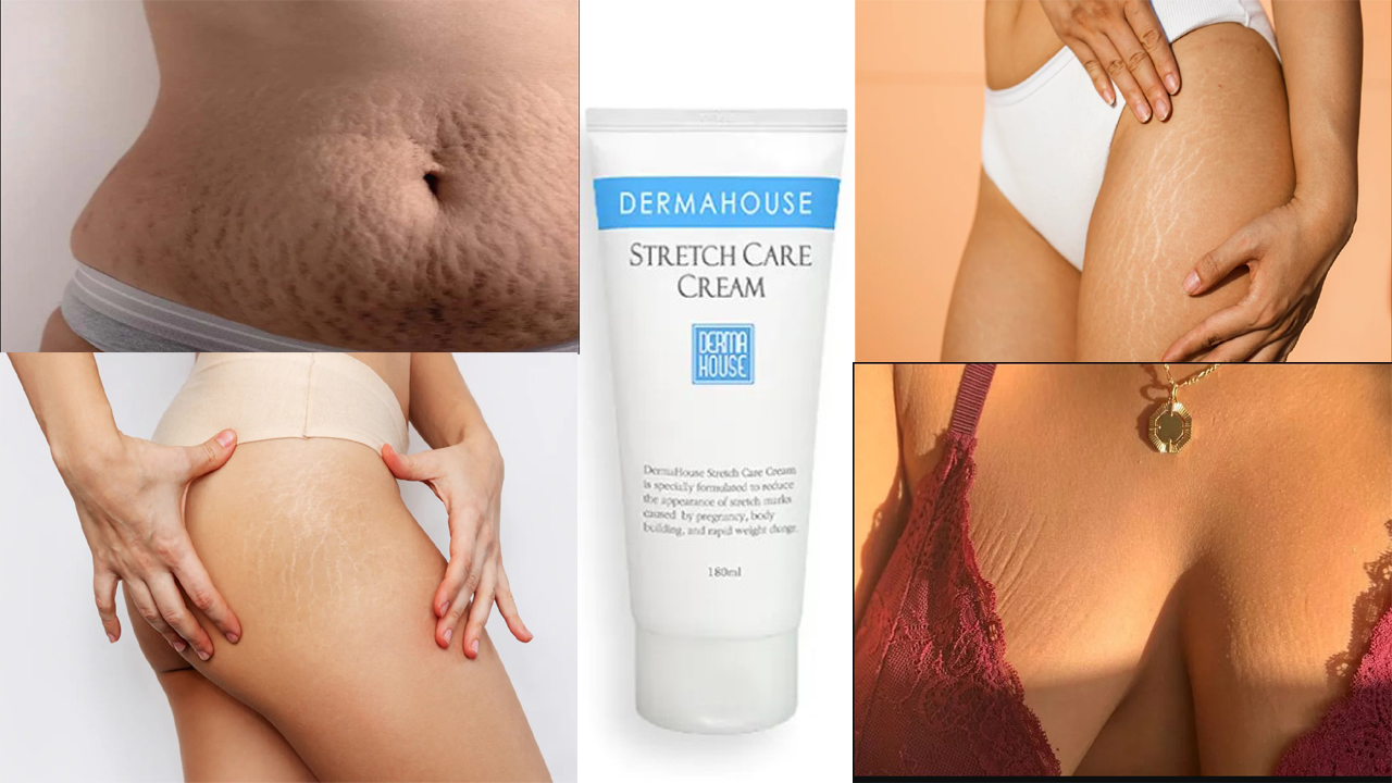 ফাটা দাগ দূর করুণ!