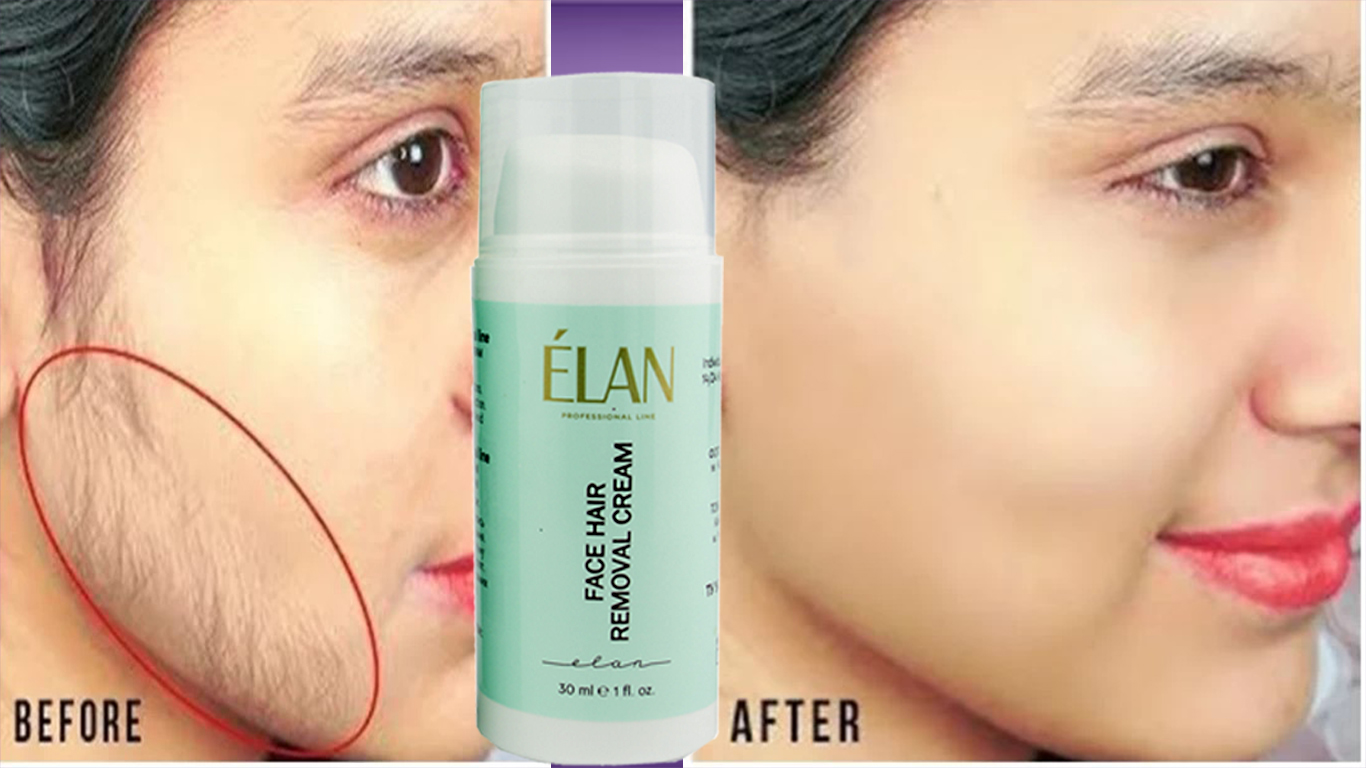 মুখের অবাঞ্ছিত লোম দূর করুণ চিরতরে!